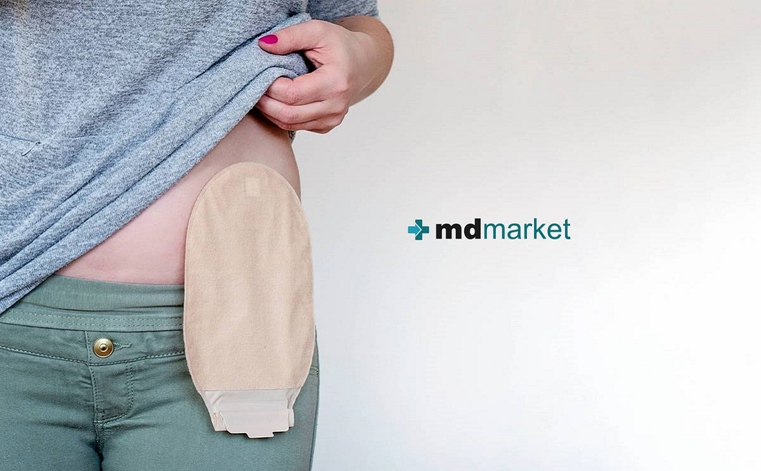 Evita fugas de tu bolsa de ostomía con estos consejos: Mdmarket