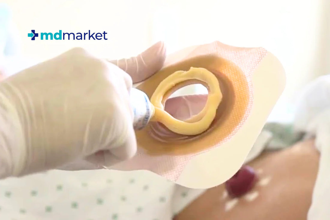 Lo último y lo mejor en cuidado de ostomías 2024-2025