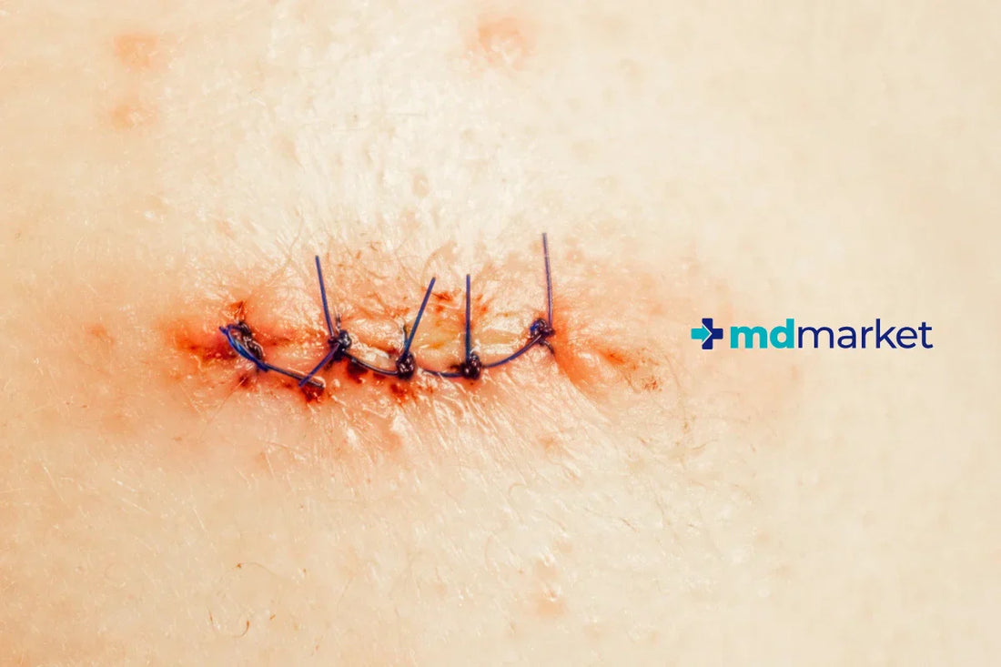 Por Qué no se Curan las Heridas: Razones Ocultas por las que tu Piel No Cicatriza