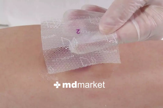 Médico aplicando un protector cutáneo sobre una herida