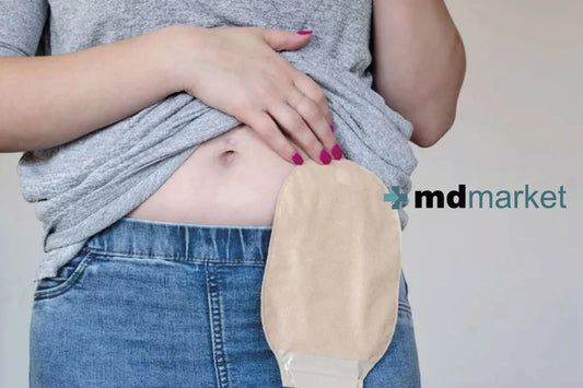 Mujer embarazada con una bolsa de ostomía